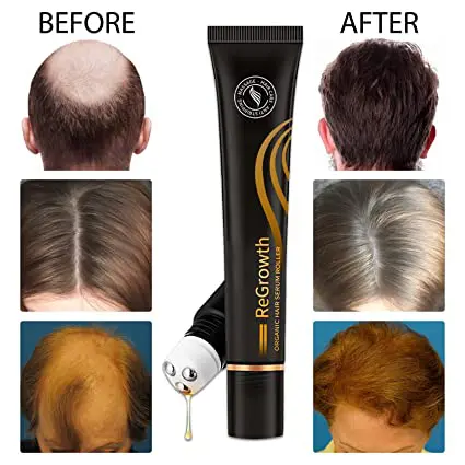 Regrowth Hair Serum - Image 5