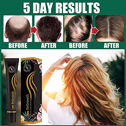 Regrowth Hair Serum